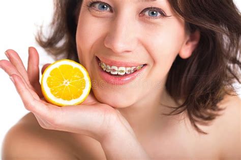 braces lemoncams|Braces .